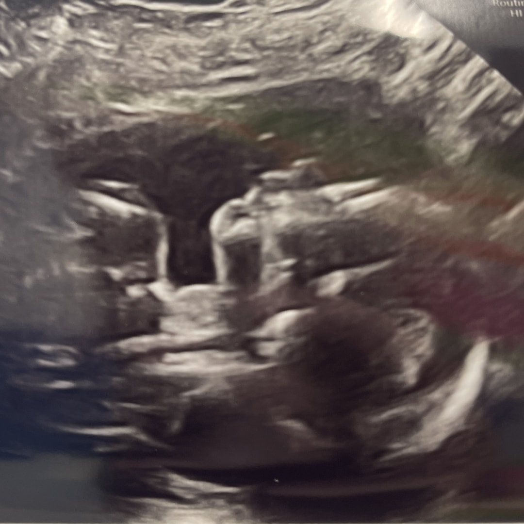 Photo shared by Anna for their Babylist baby registry.