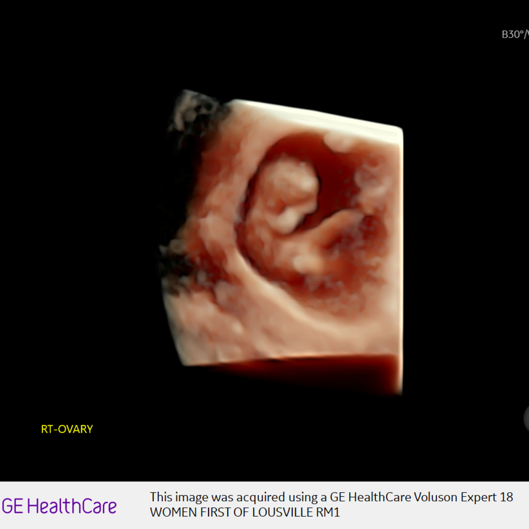 Photo shared by Hannah for their Babylist baby registry.