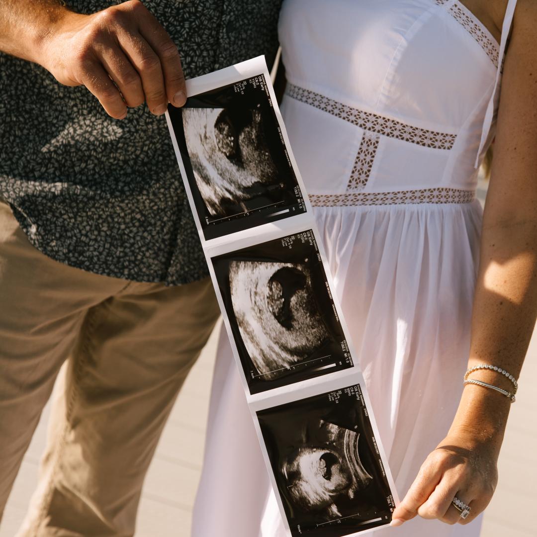 Photo shared by Maddi for their Babylist baby registry.
