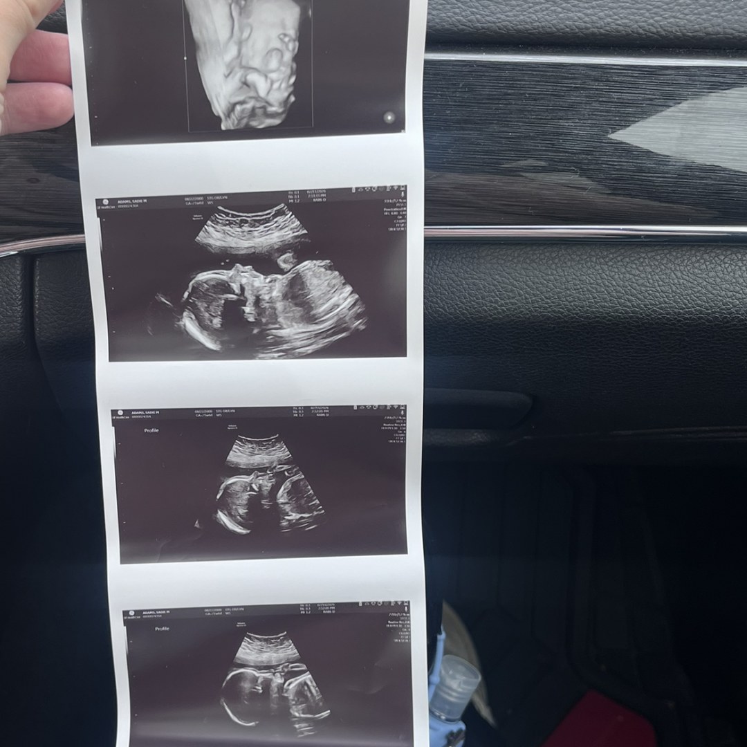 Photo shared by Sadie for their Babylist baby registry.