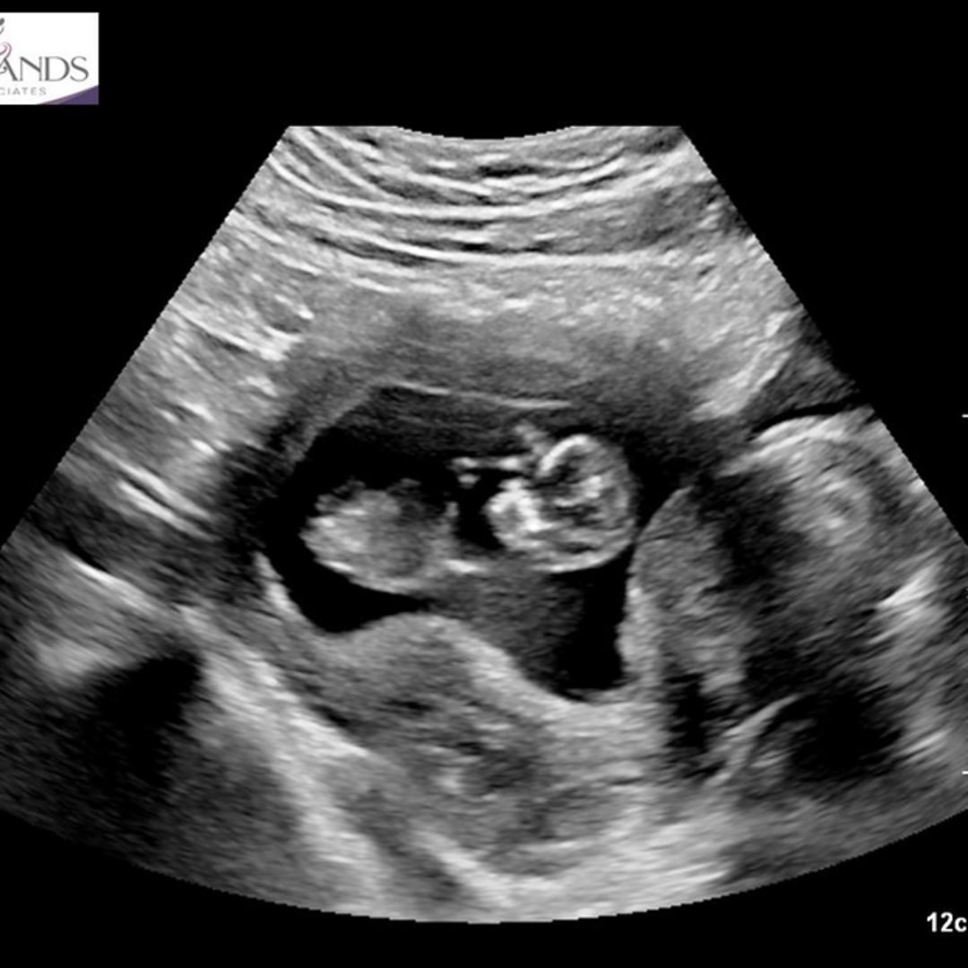 Photo shared by Karla Vanessa for their Babylist baby registry.