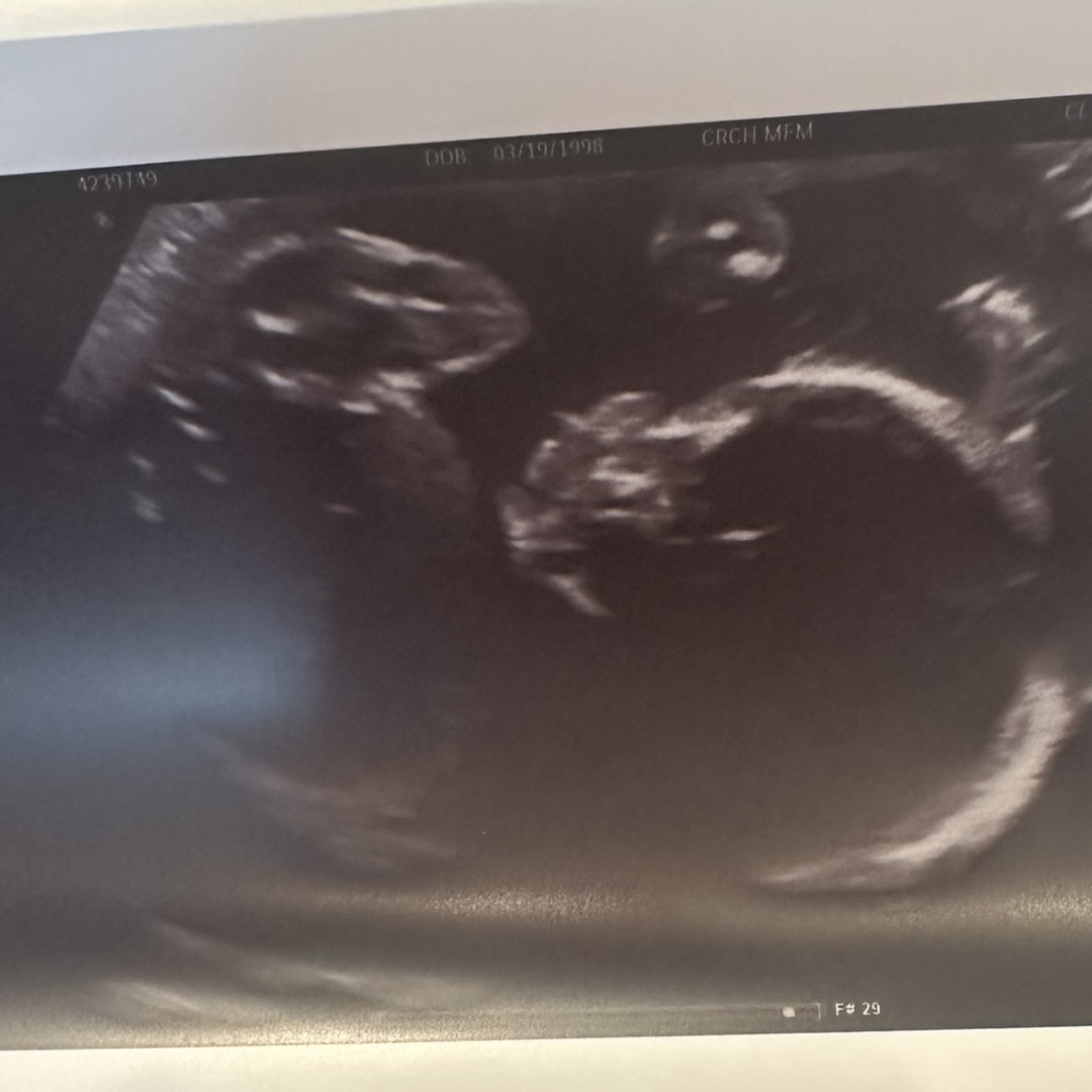 Photo shared by De’ja for their Babylist baby registry.