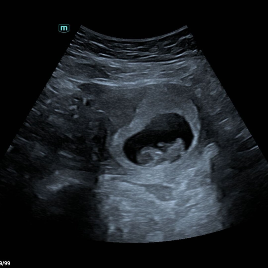 Photo shared by Mackenzie for their Babylist baby registry.
