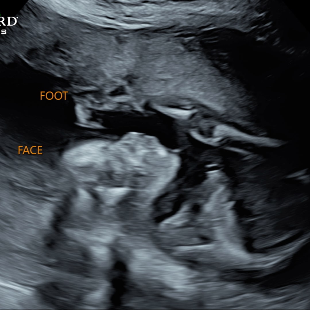 Photo shared by Shailey for their Babylist baby registry.