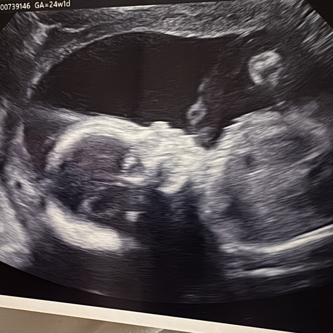 Photo shared by Abbie for their Babylist baby registry.