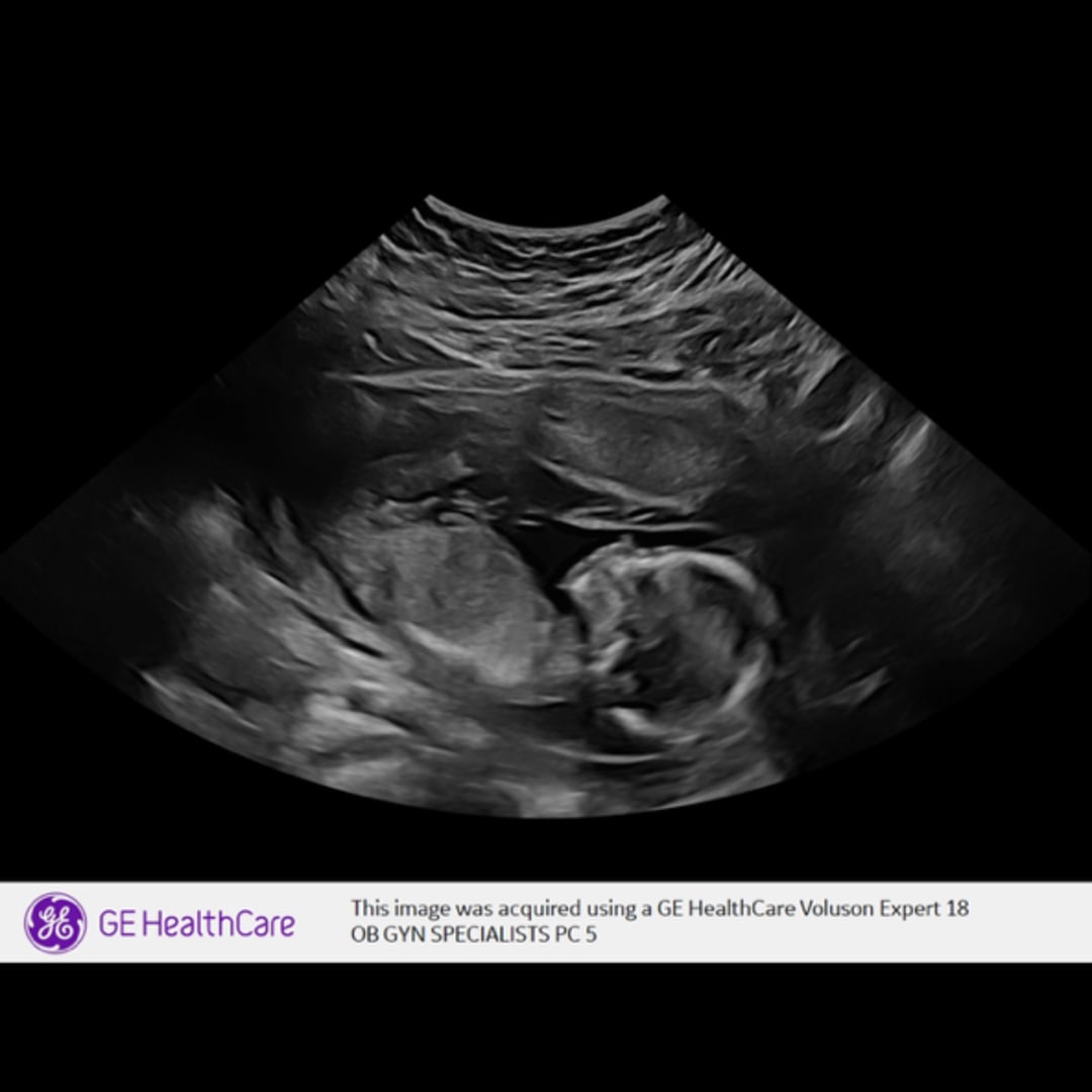 Photo shared by Abby for their Babylist baby registry.