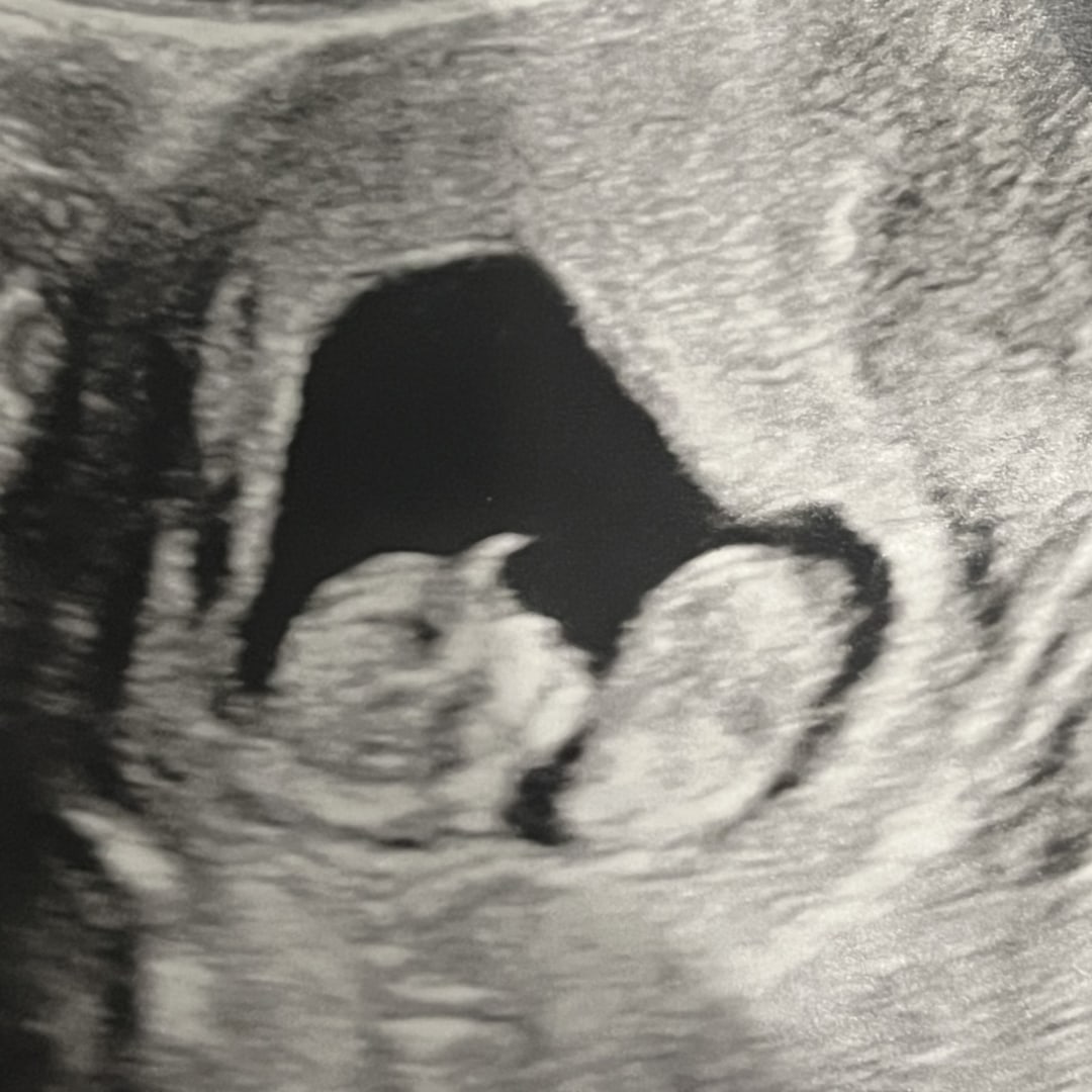 Photo shared by Tesla for their Babylist baby registry.