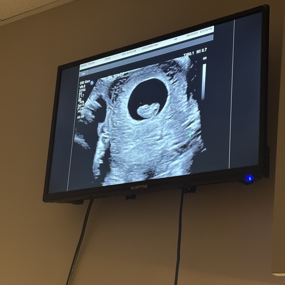 Photo shared by Clarence for their Babylist baby registry.