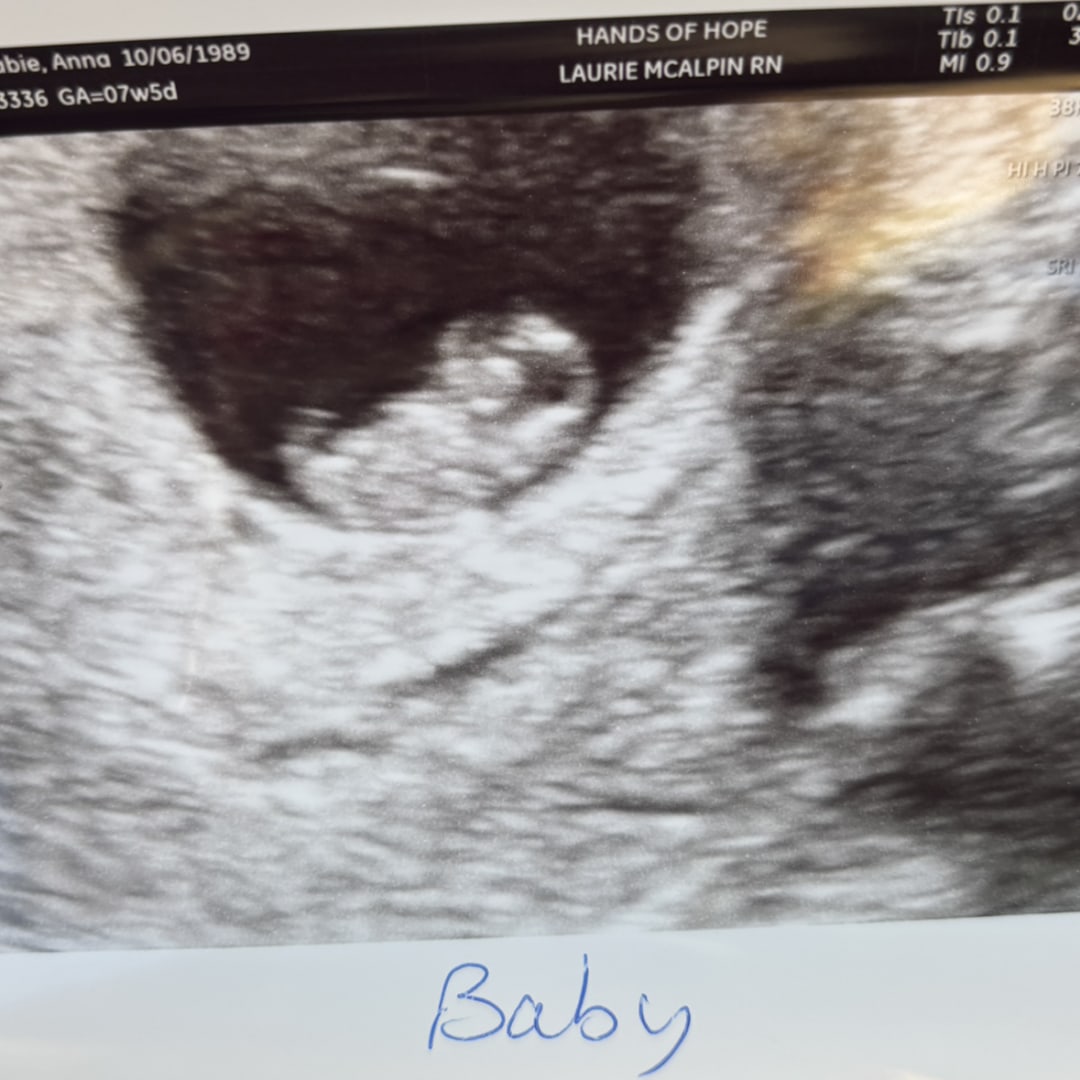 Photo shared by Anna for their Babylist baby registry.