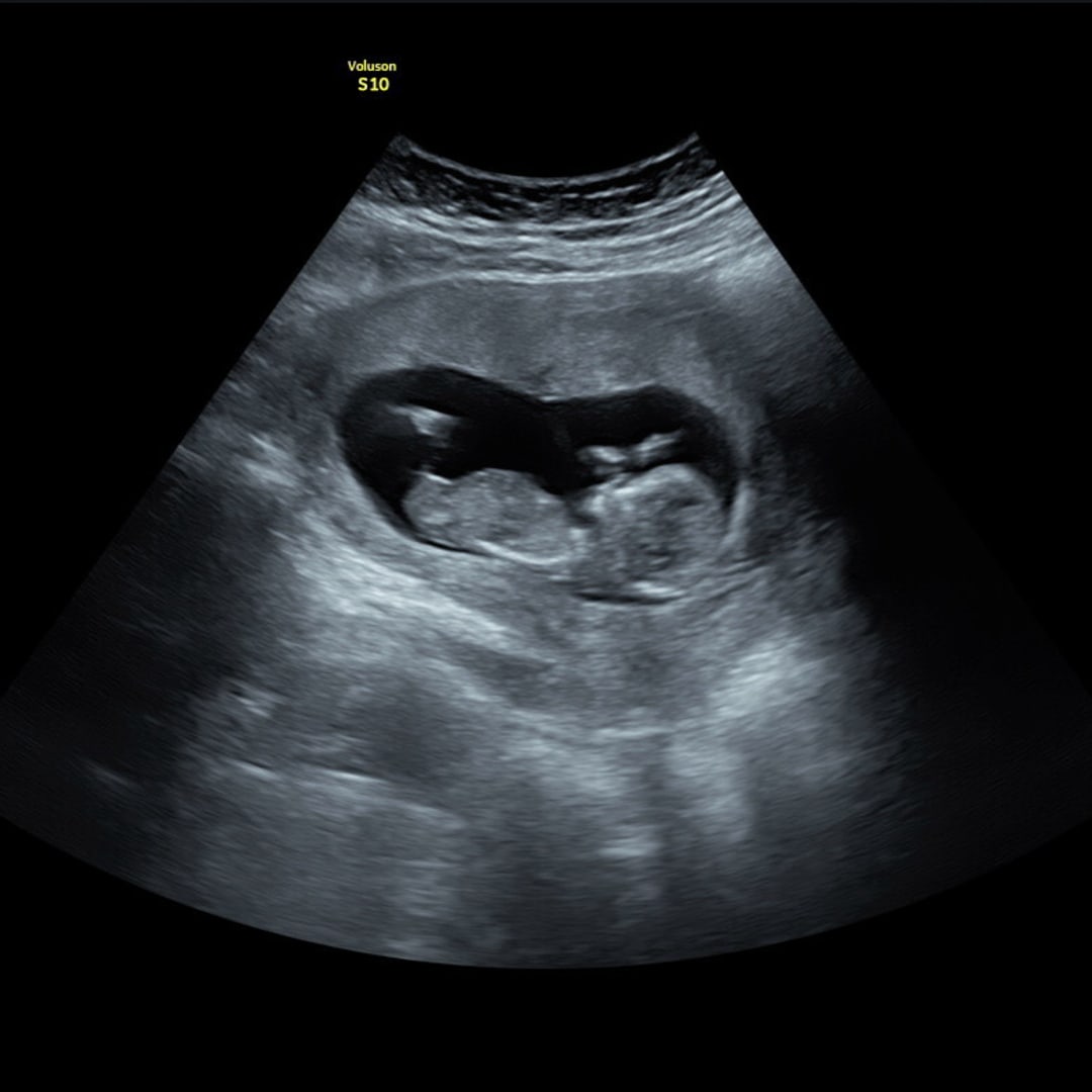 Photo shared by Heidi for their Babylist baby registry.