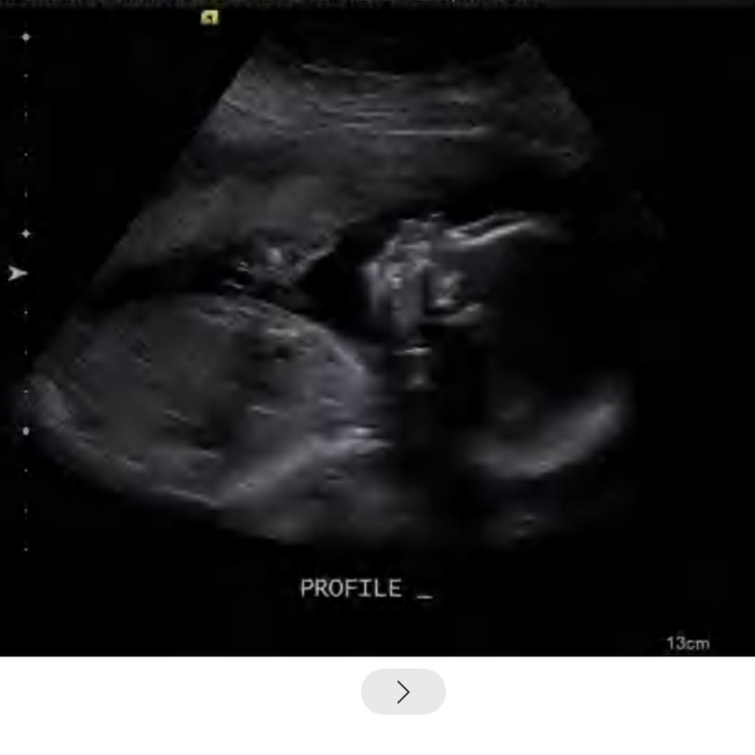 Photo shared by Makaila for their Babylist baby registry.