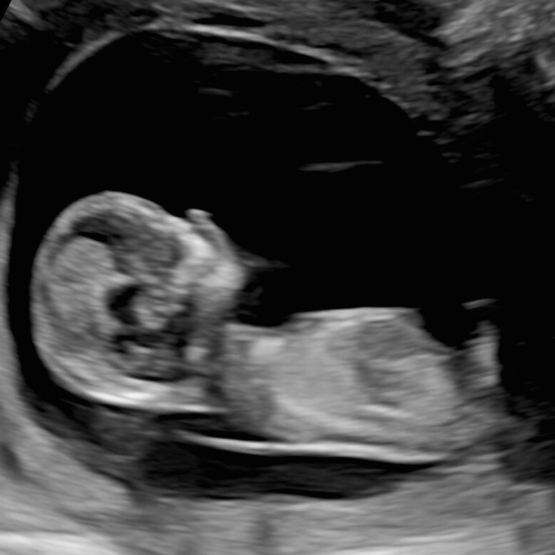 Photo shared by Josie for their Babylist baby registry.