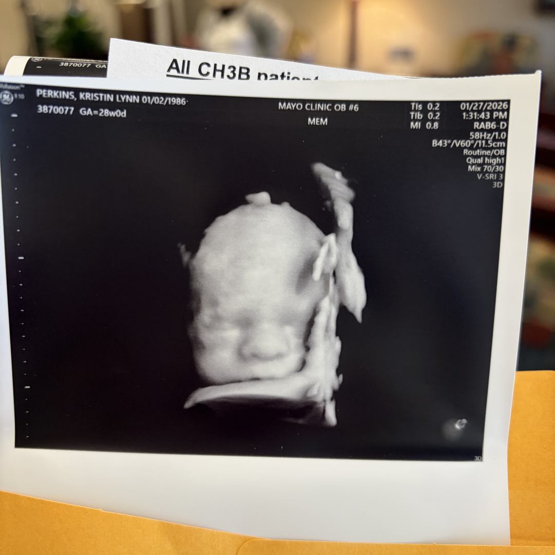 Photo shared by Kristin for their Babylist baby registry.