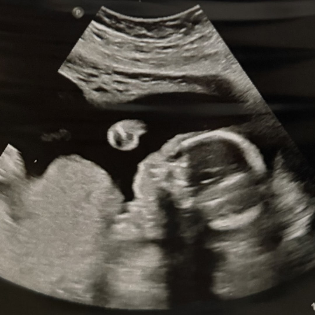 Photo shared by Katlyn for their Babylist baby registry.