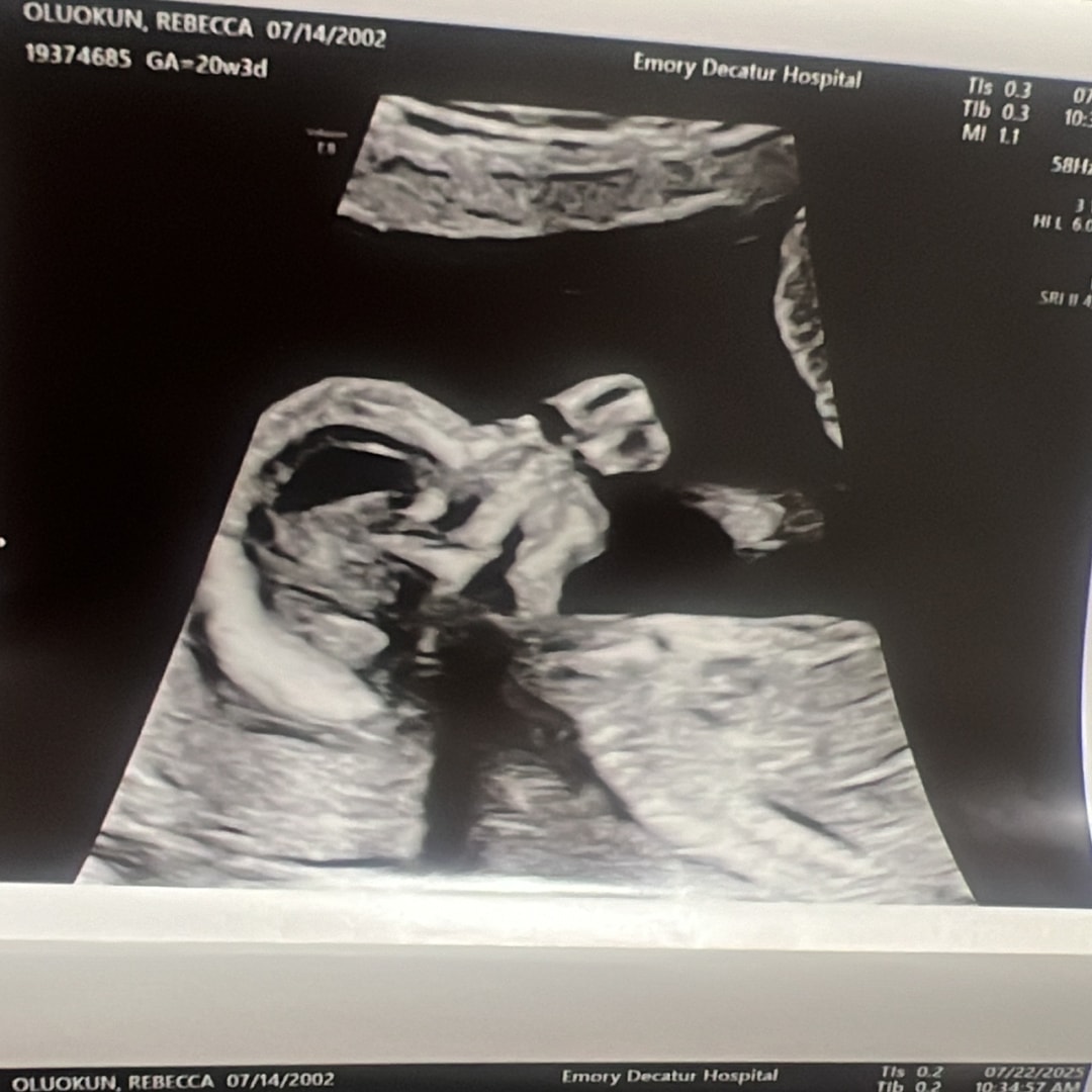 Photo shared by Rebecca for their Babylist baby registry.