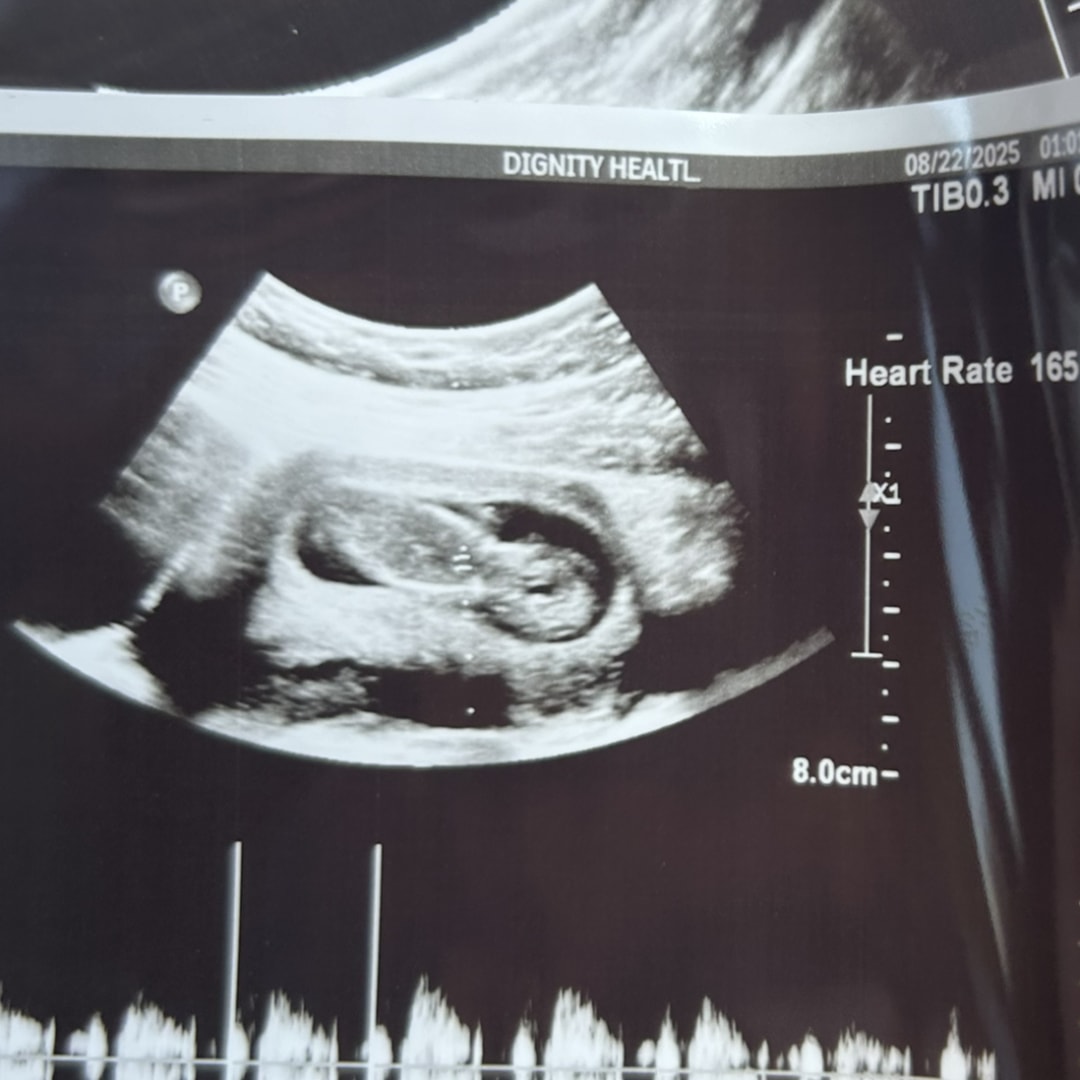 Photo shared by Kayla for their Babylist baby registry.