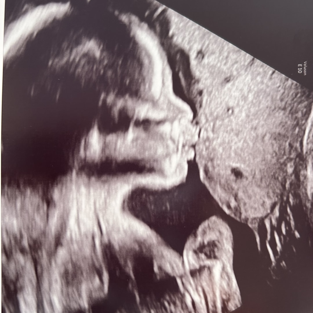 Photo shared by Tanéja for their Babylist baby registry.