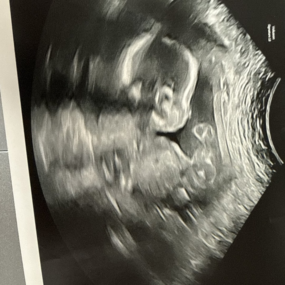 Photo shared by Jamie for their Babylist baby registry.
