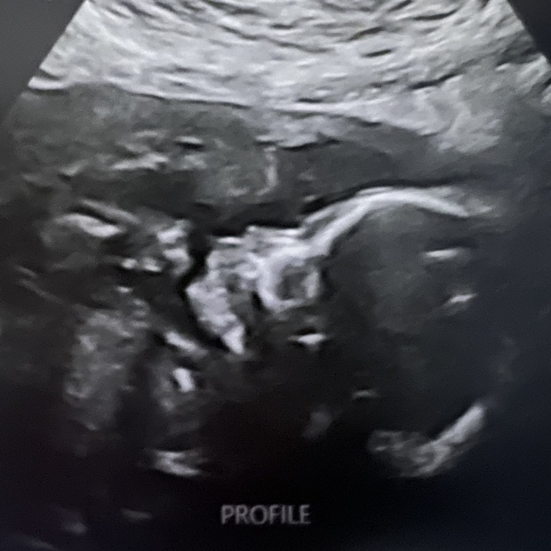 Photo shared by Stephanie for their Babylist baby registry.