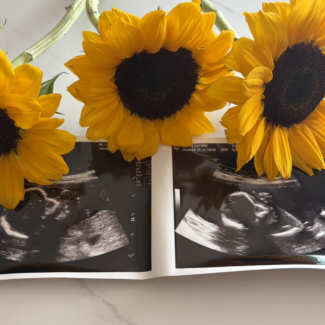 Photo shared by Savannah for their Babylist baby registry.