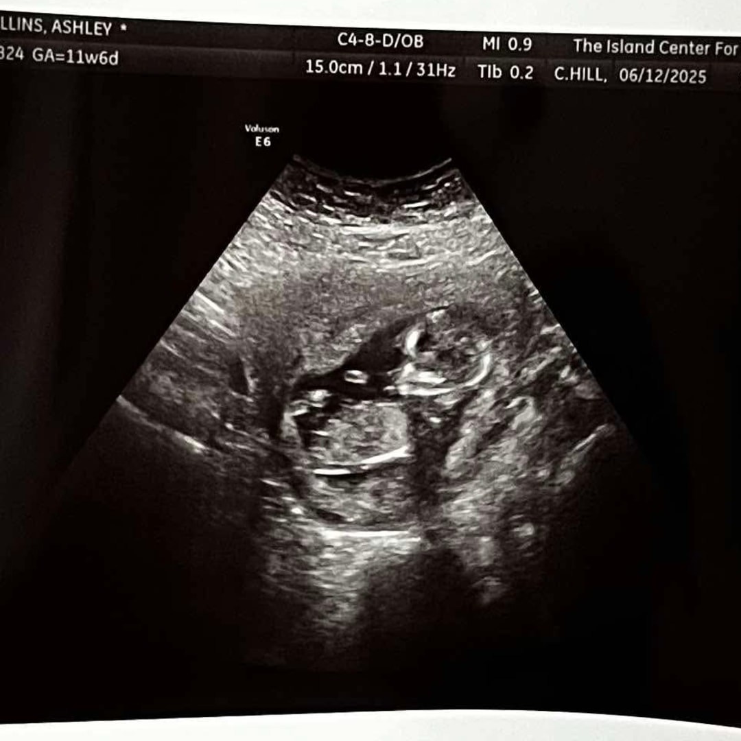 Photo shared by Ashley for their Babylist baby registry.