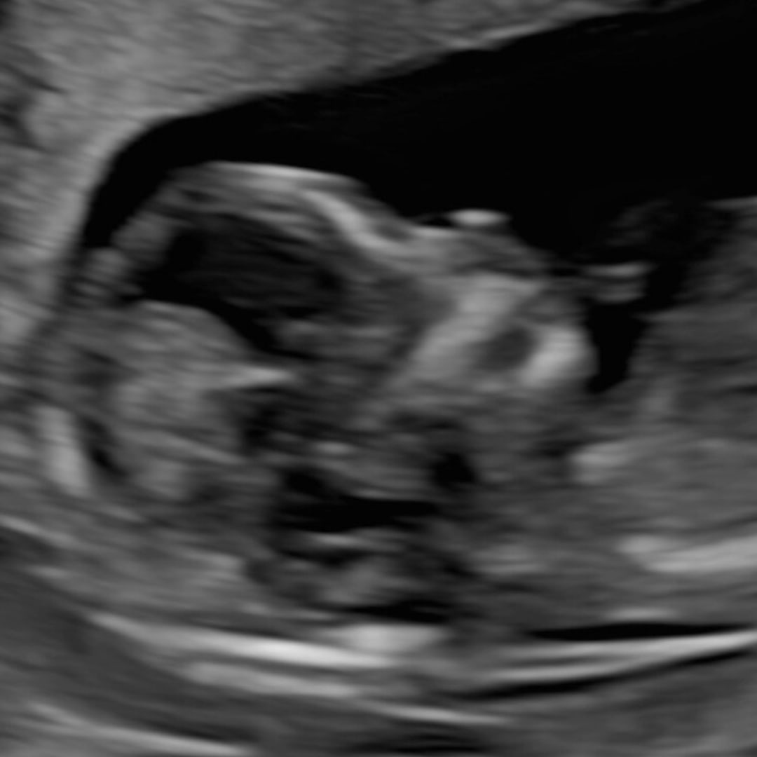 Photo shared by Jacky for their Babylist baby registry.