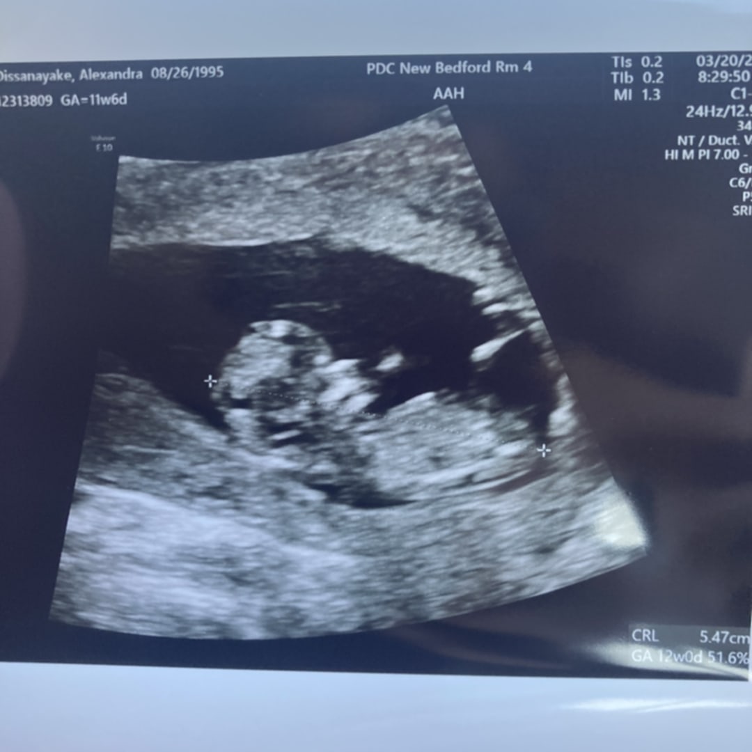 Photo shared by Alexandra for their Babylist baby registry.