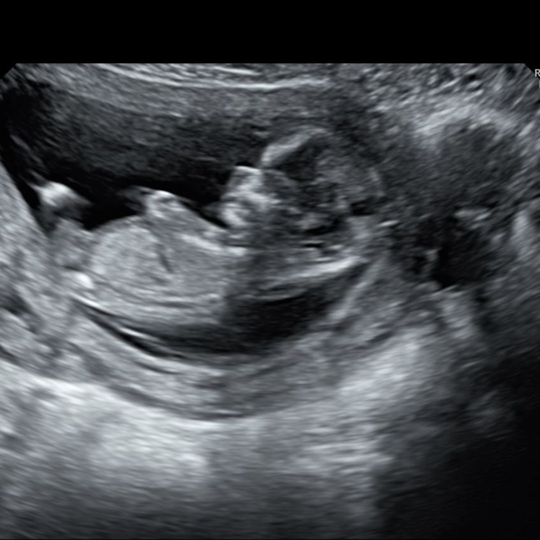 Photo shared by Lydia for their Babylist baby registry.