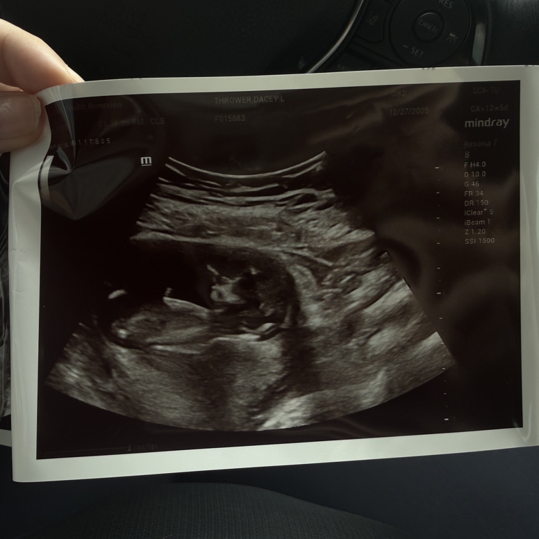 Photo shared by Dacey for their Babylist baby registry.
