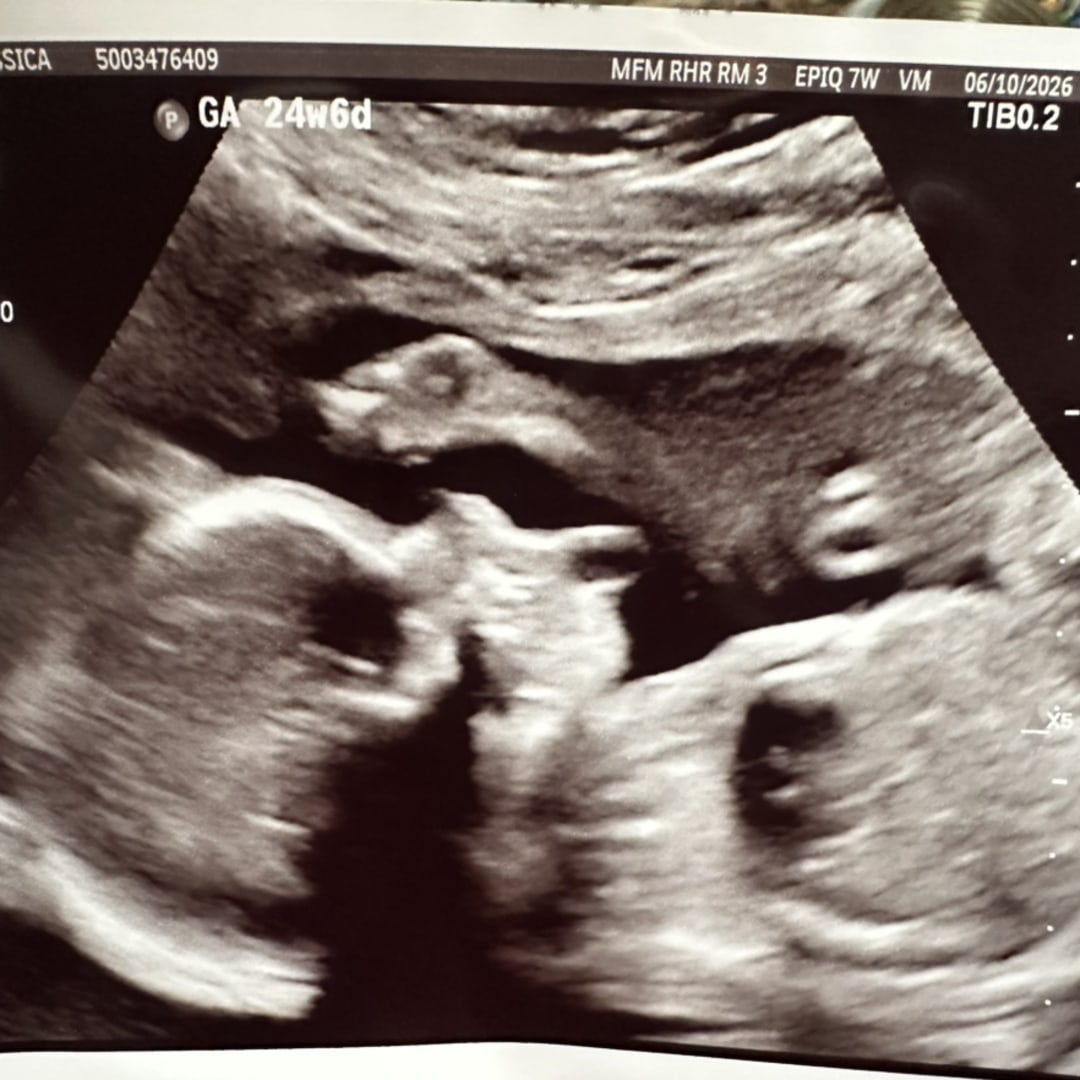 Photo shared by Jessica for their Babylist baby registry.