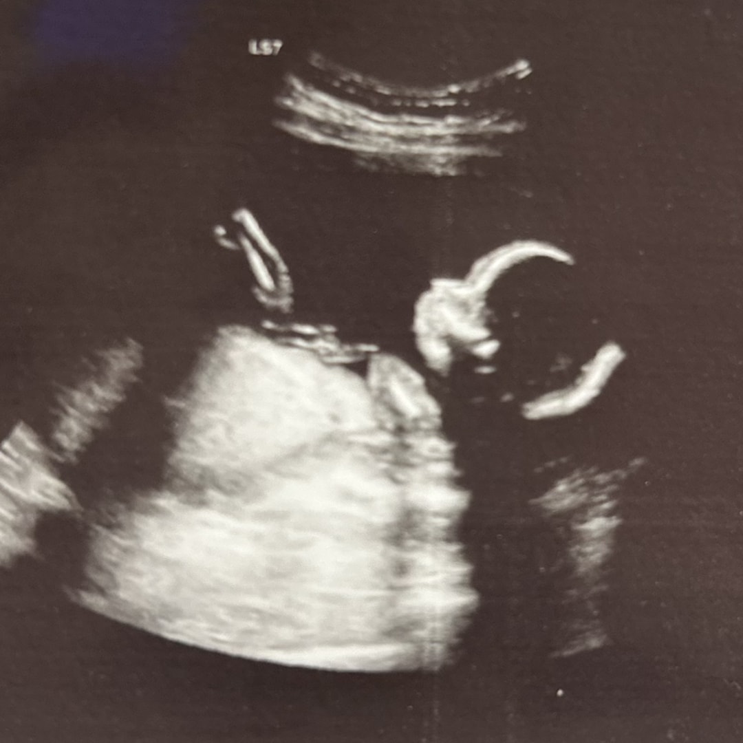 Photo shared by Hannah for their Babylist baby registry.