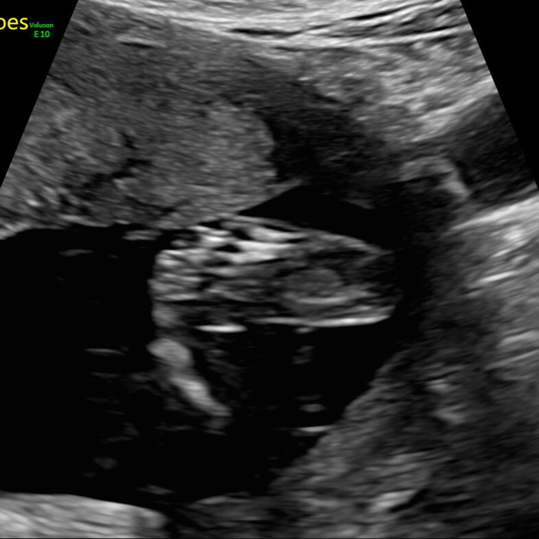 Photo shared by Gabriela for their Babylist baby registry.