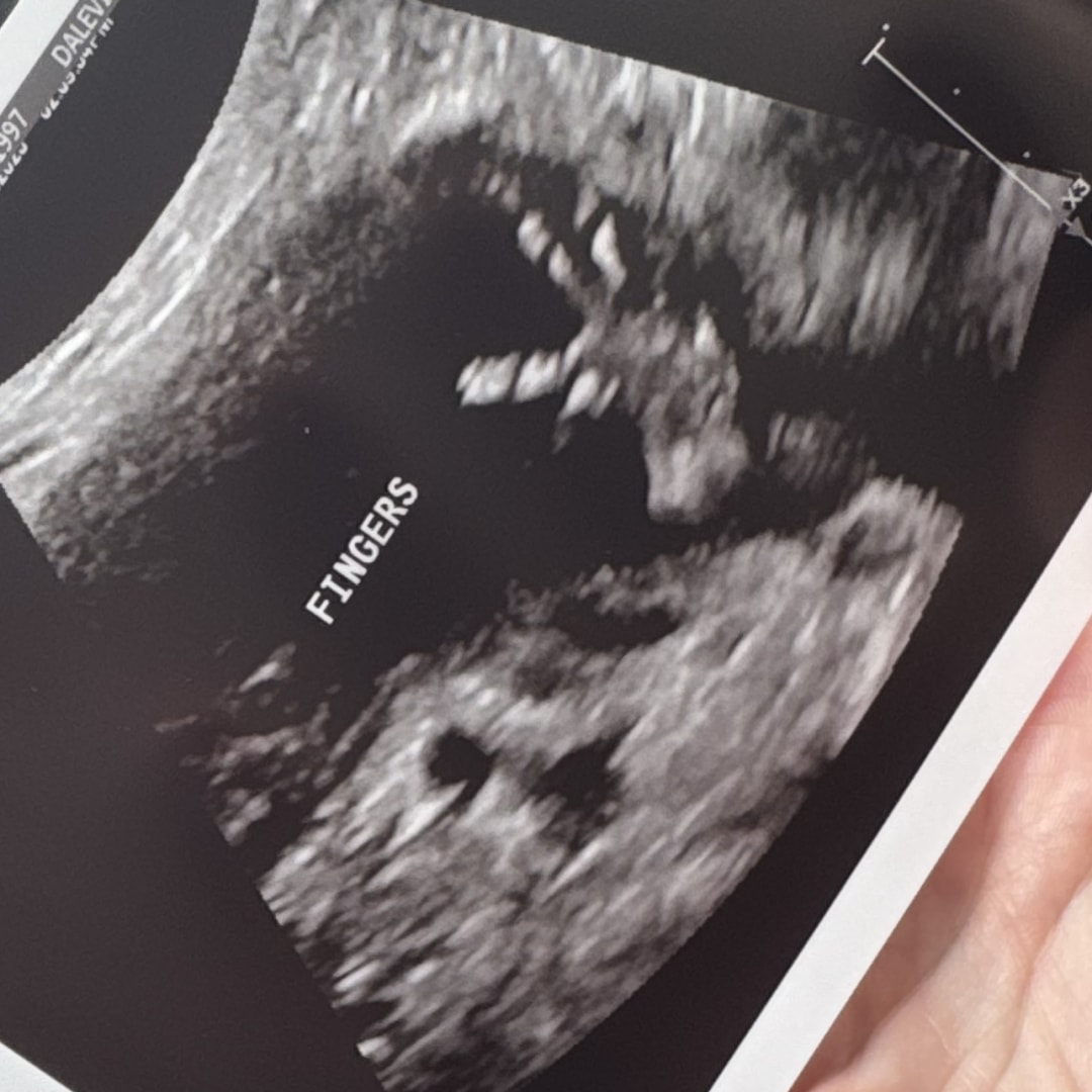 Photo shared by Hope for their Babylist baby registry.