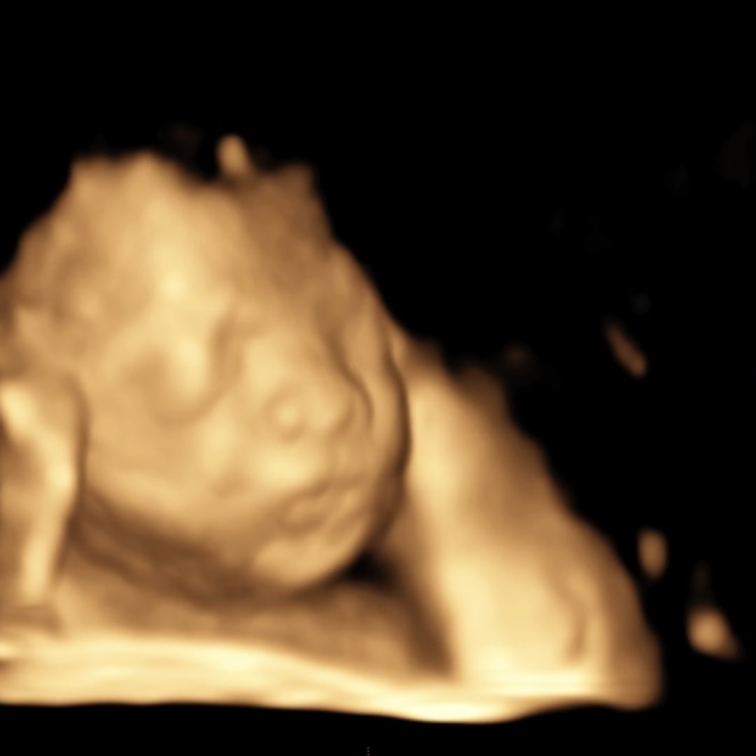 Photo shared by Deziree for their Babylist baby registry.