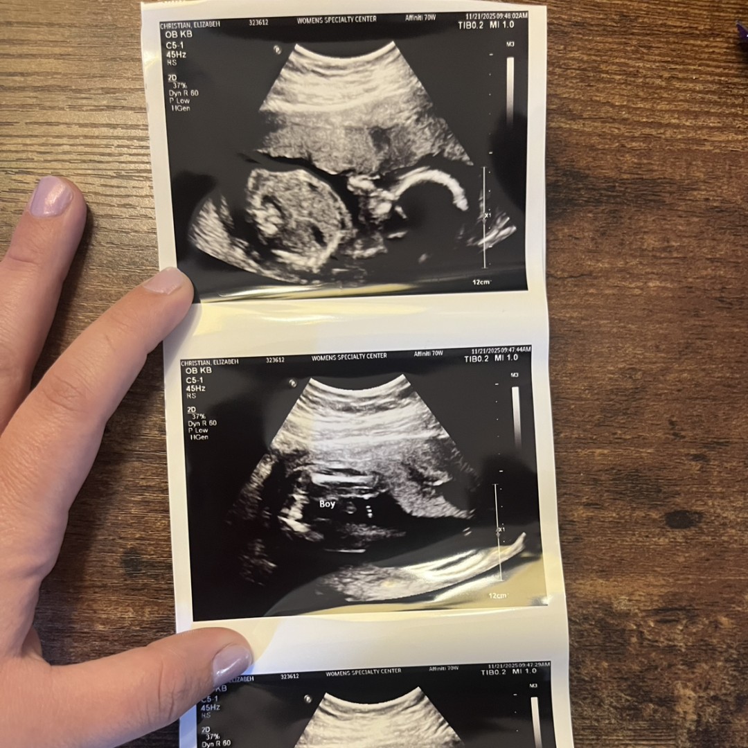 Photo shared by Elizabeth for their Babylist baby registry.