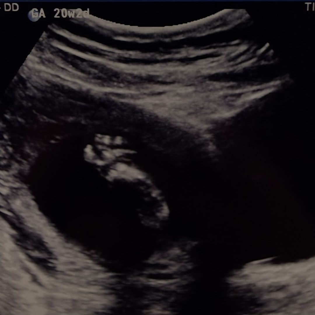 Photo shared by Emilie for their Babylist baby registry.