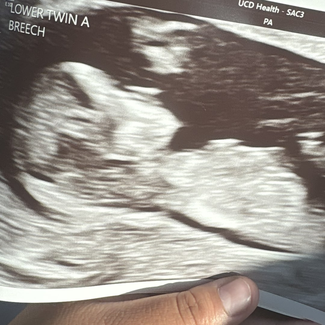 Photo shared by Zuleyma for their Babylist baby registry.