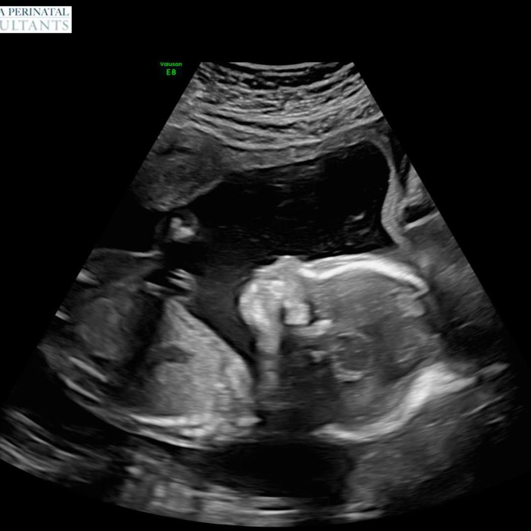 Photo shared by Mary Michael for their Babylist baby registry.