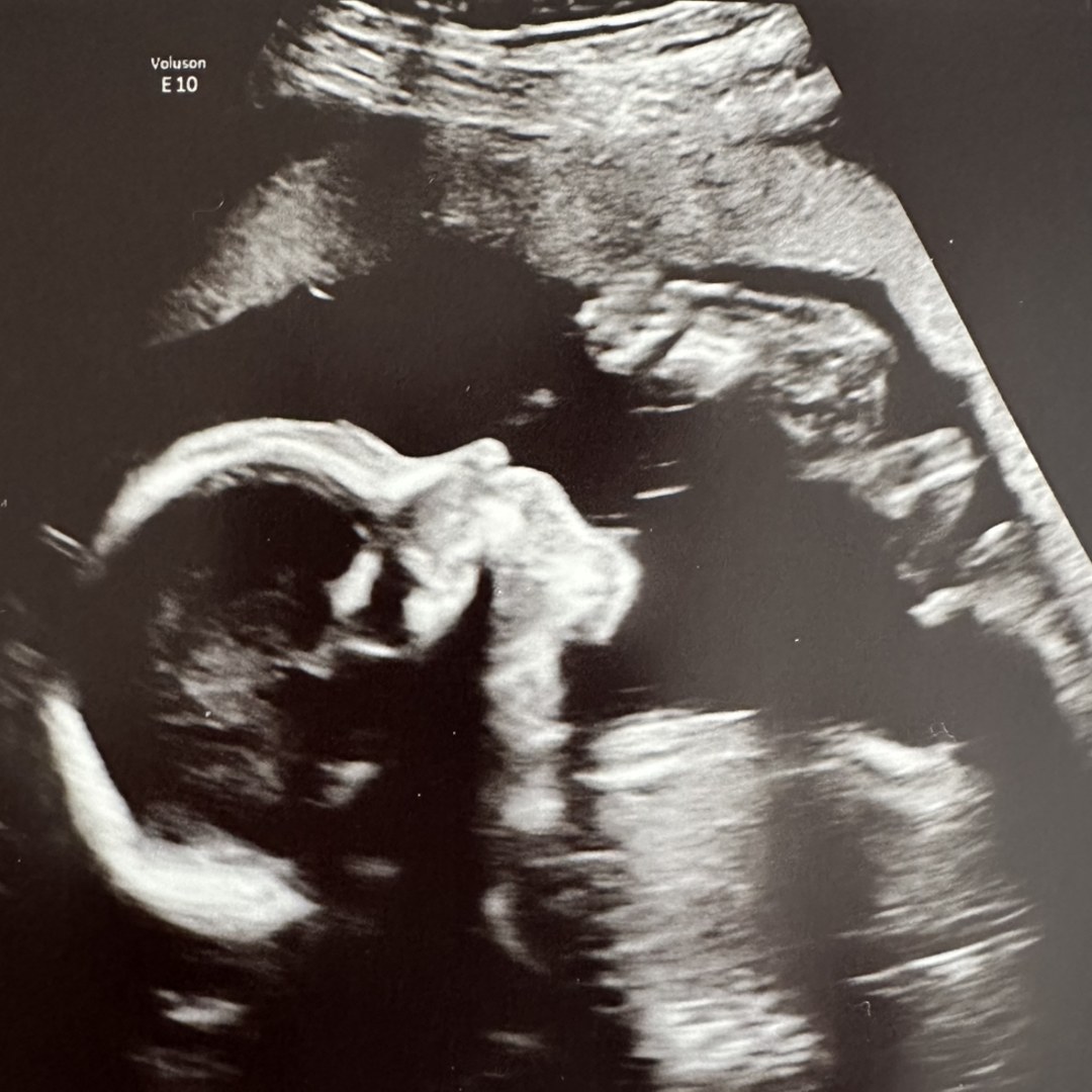 Photo shared by Katie for their Babylist baby registry.