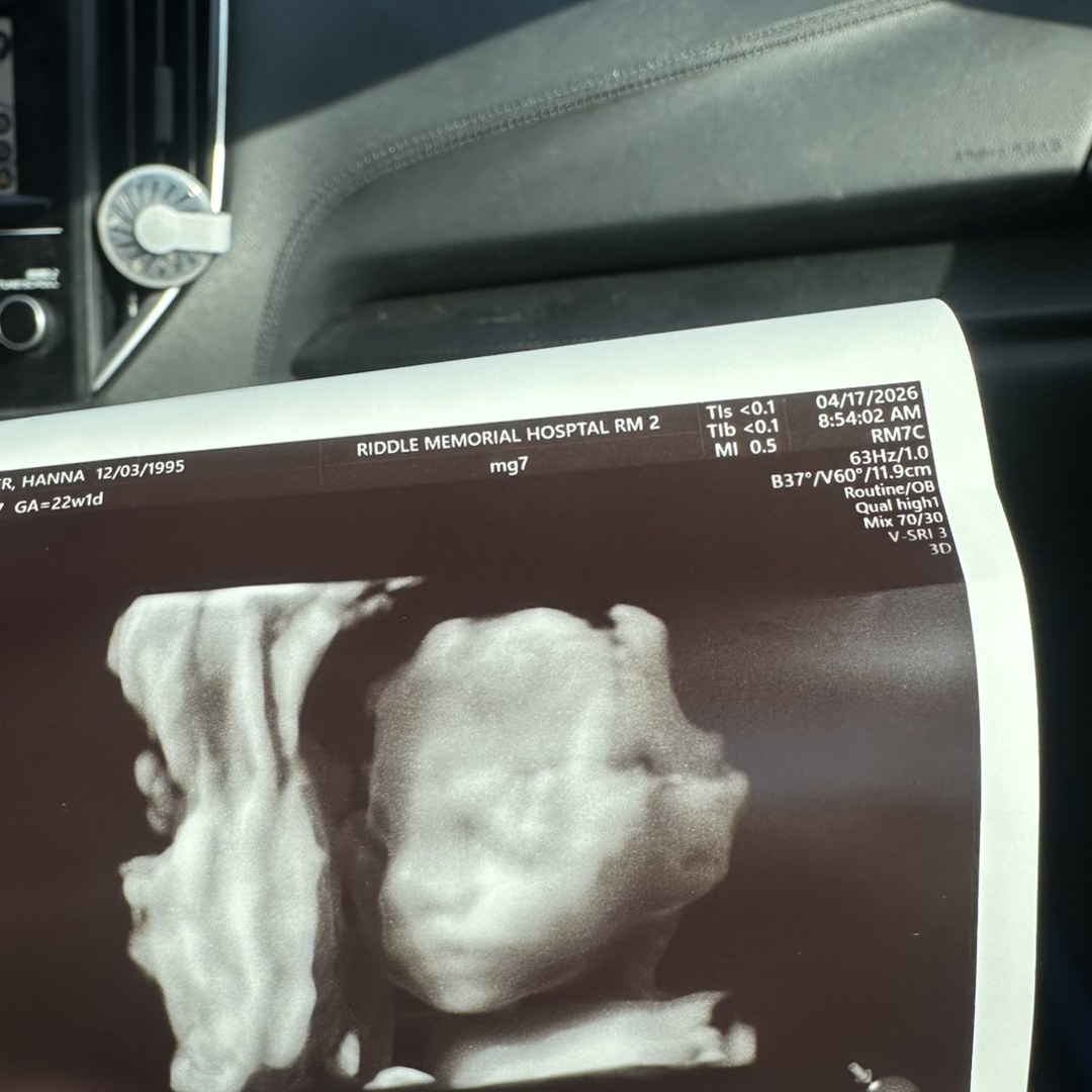 Photo shared by Hanna for their Babylist baby registry.