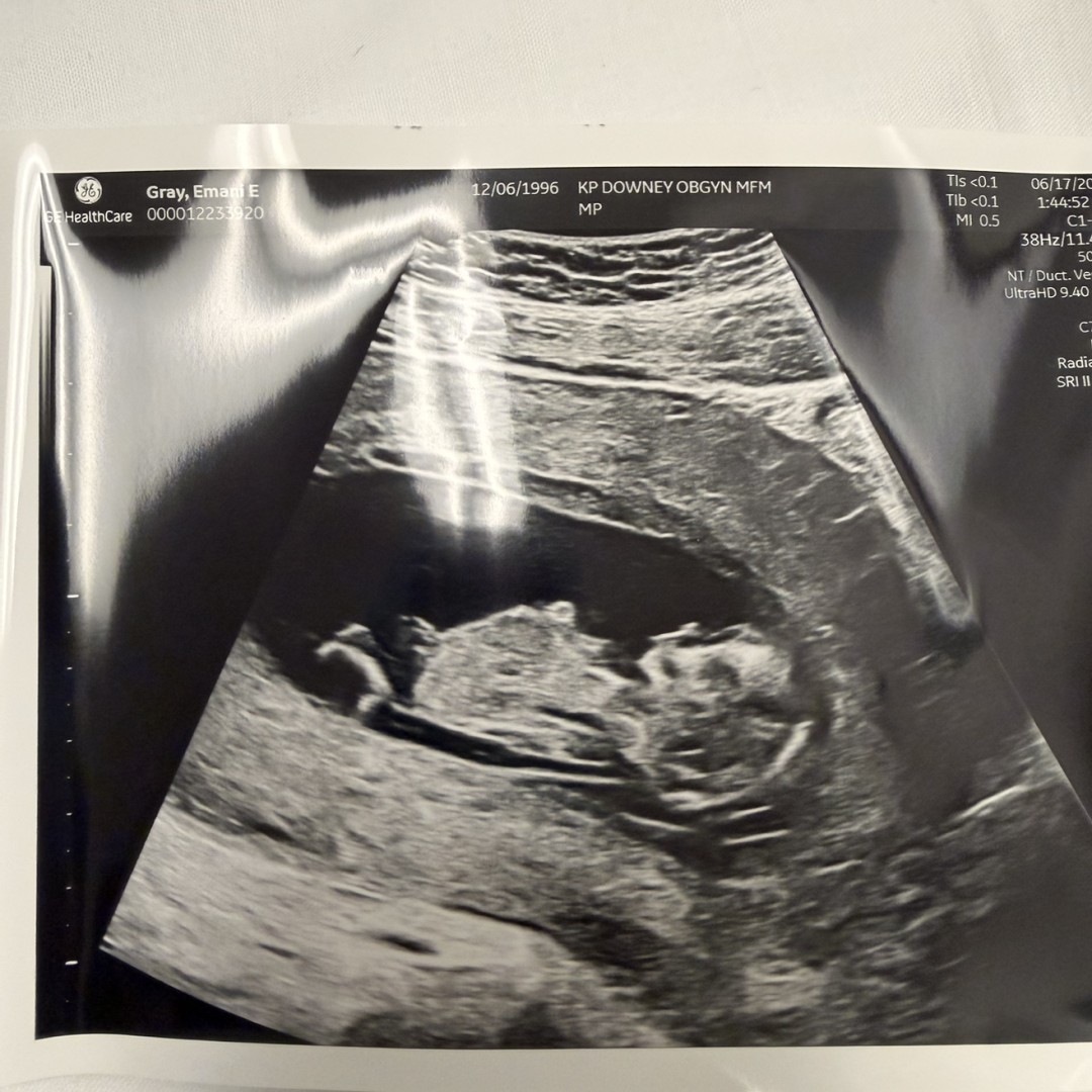Photo shared by DeAngelo for their Babylist baby registry.