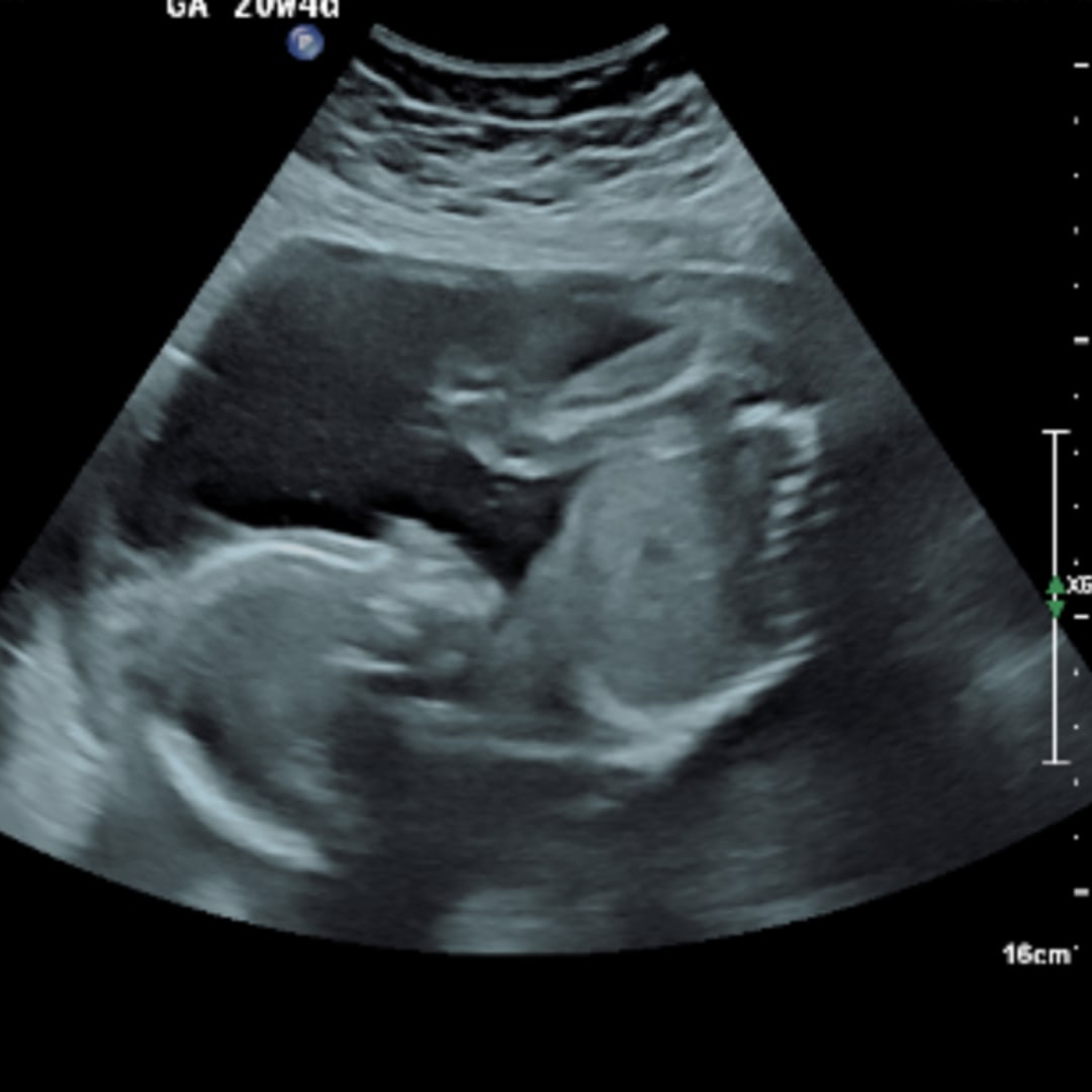 Photo shared by Alyssa for their Babylist baby registry.