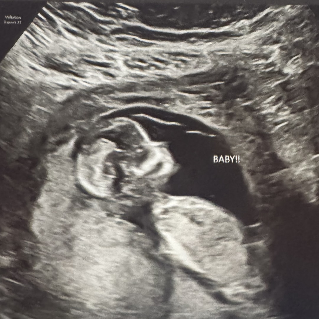 Photo shared by Grace for their Babylist baby registry.