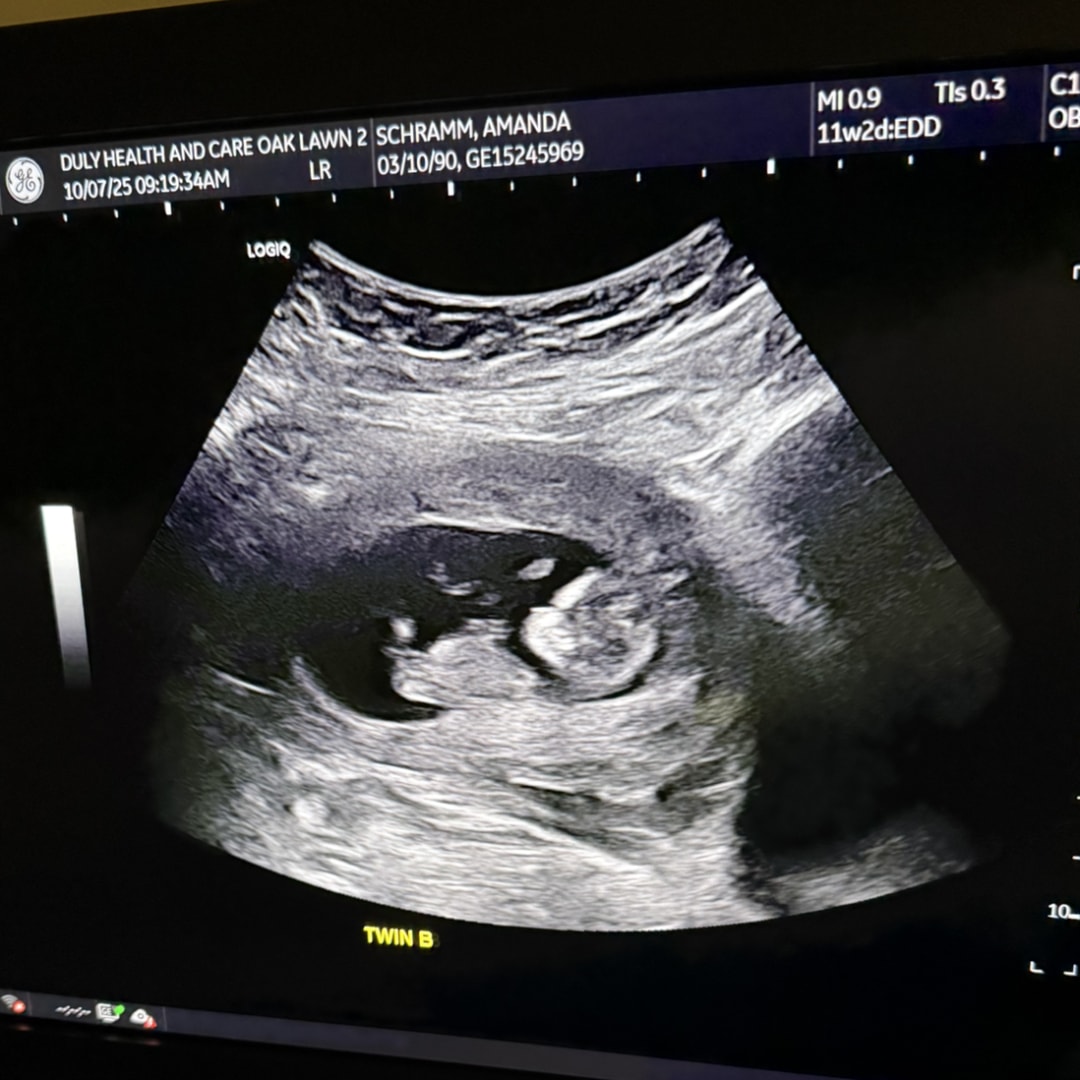 Photo shared by Amanda for their Babylist baby registry.