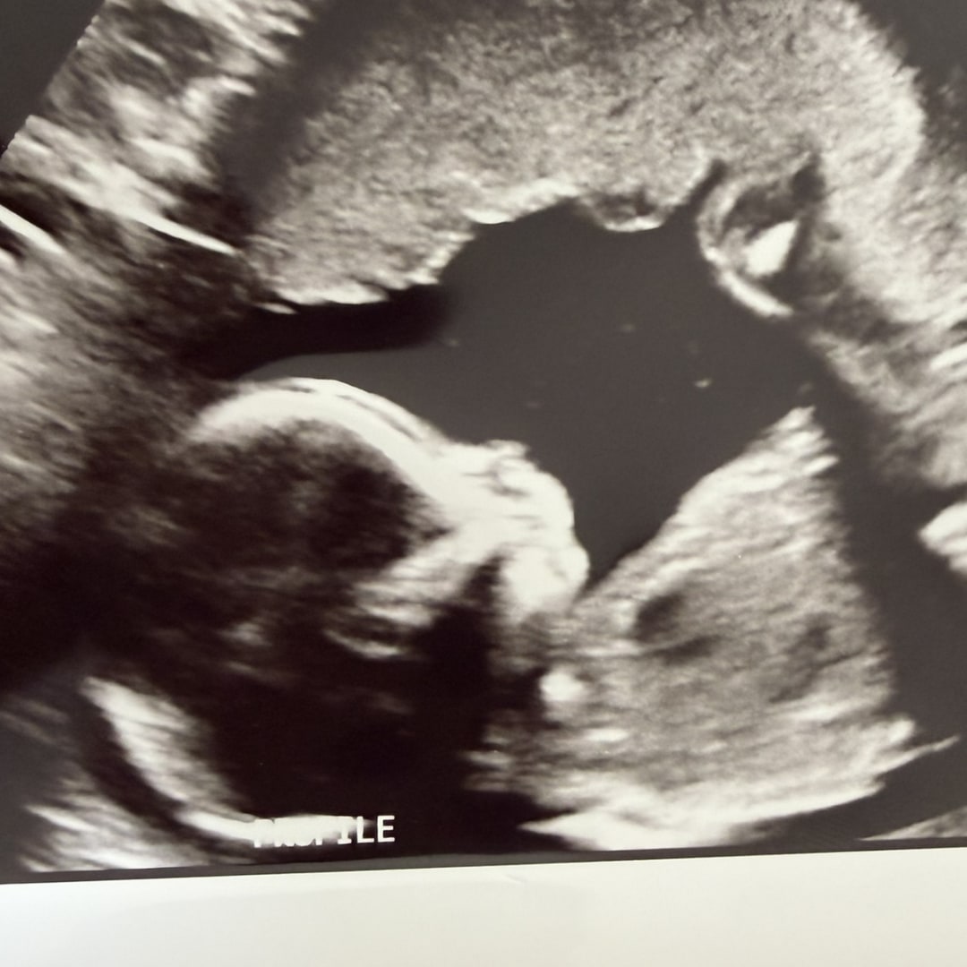 Photo shared by Ellen for their Babylist baby registry.