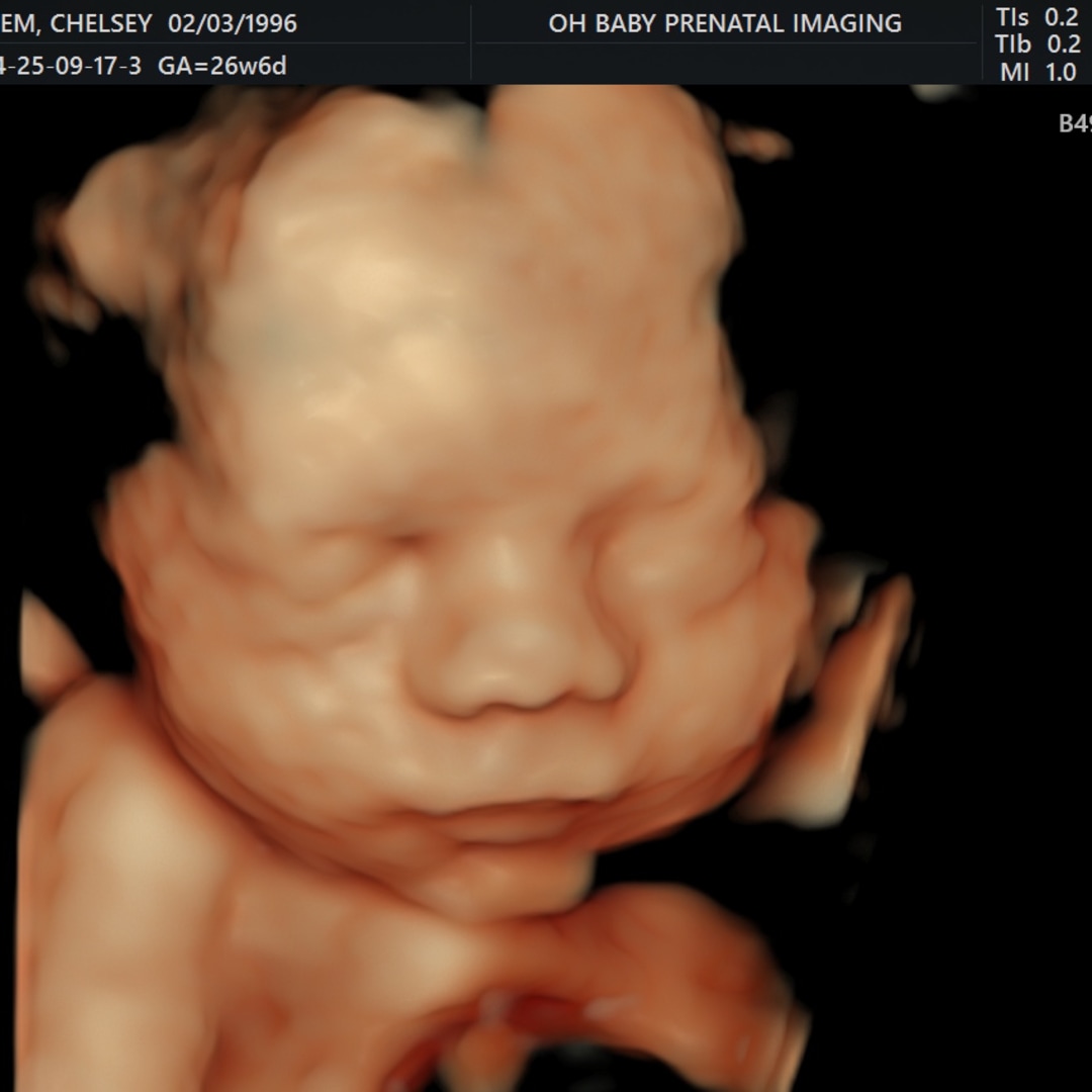Photo shared by Chelsey for their Babylist baby registry.