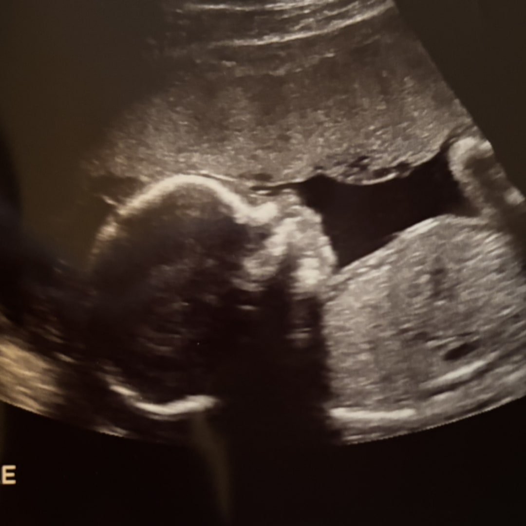Photo shared by Alie for their Babylist baby registry.