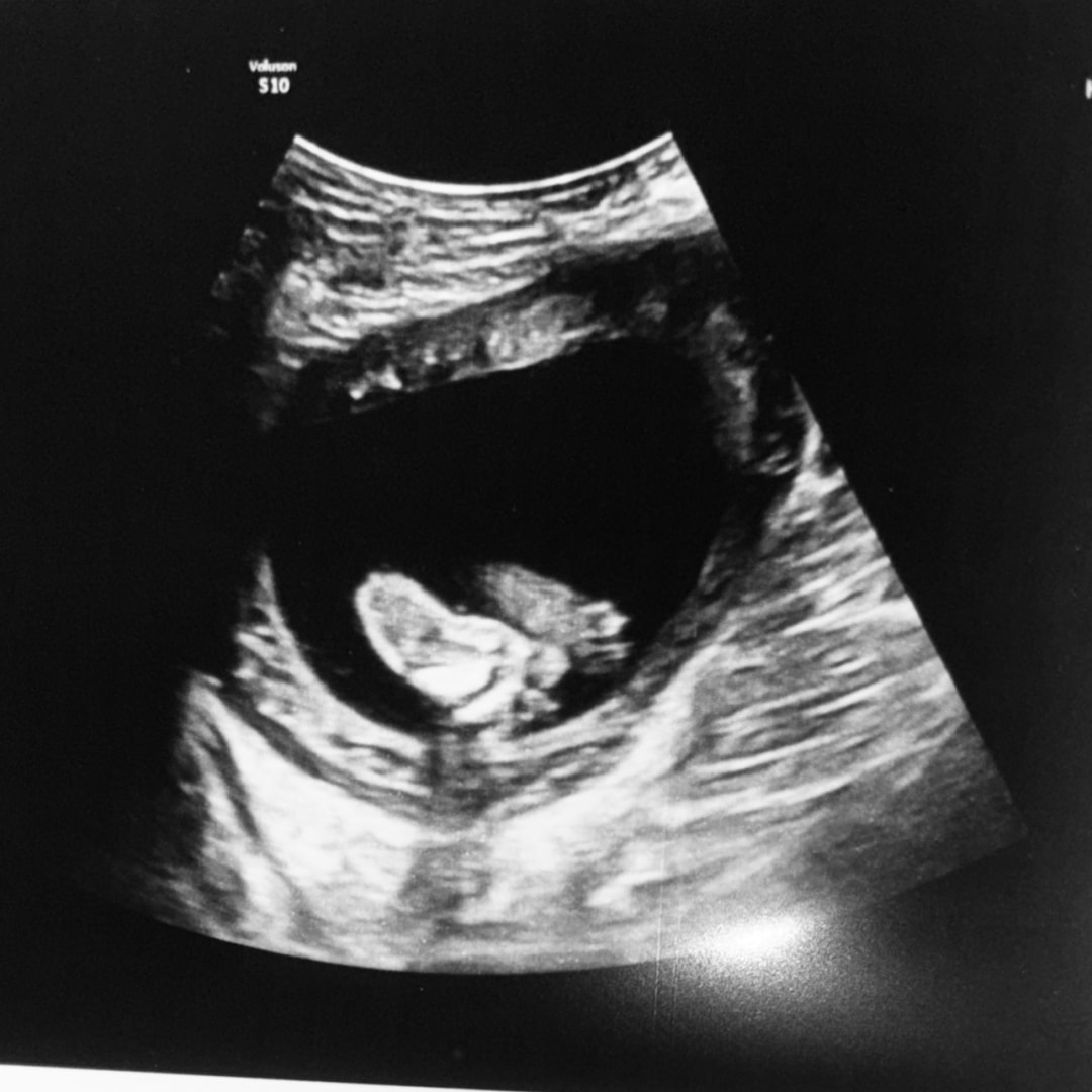 Photo shared by Kalli for their Babylist baby registry.