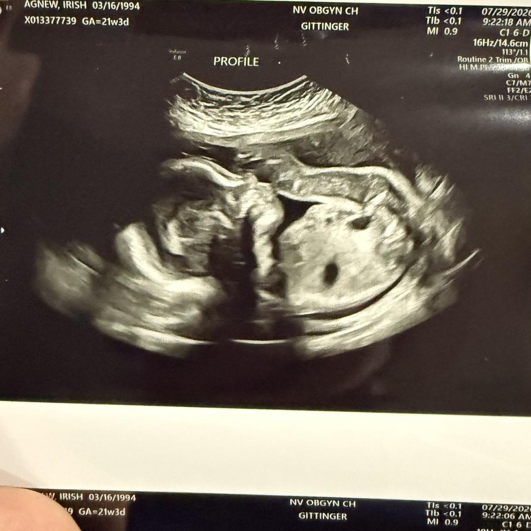 Photo shared by Irish for their Babylist baby registry.