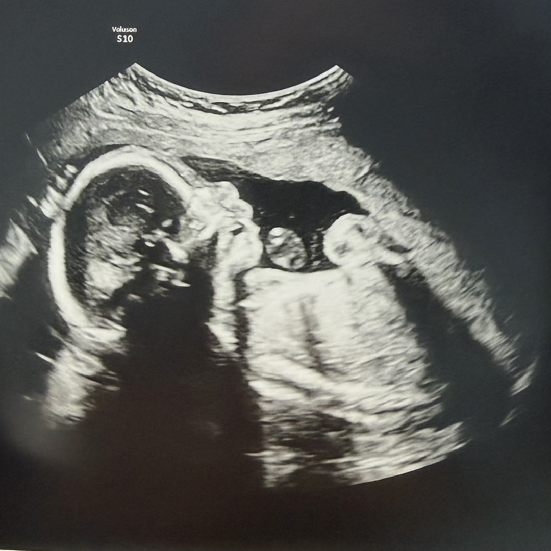 Photo shared by Cameron for their Babylist baby registry.